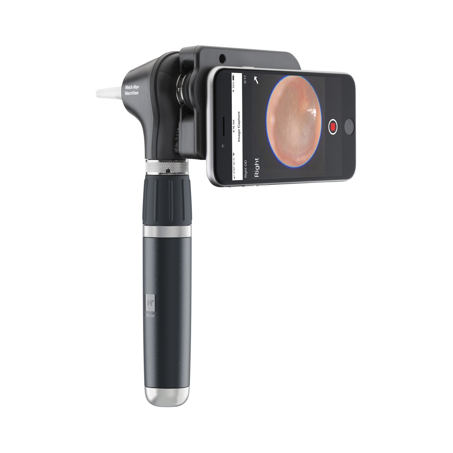 Welch Allyn MacroView Plus Otoscope Head for iExaminer