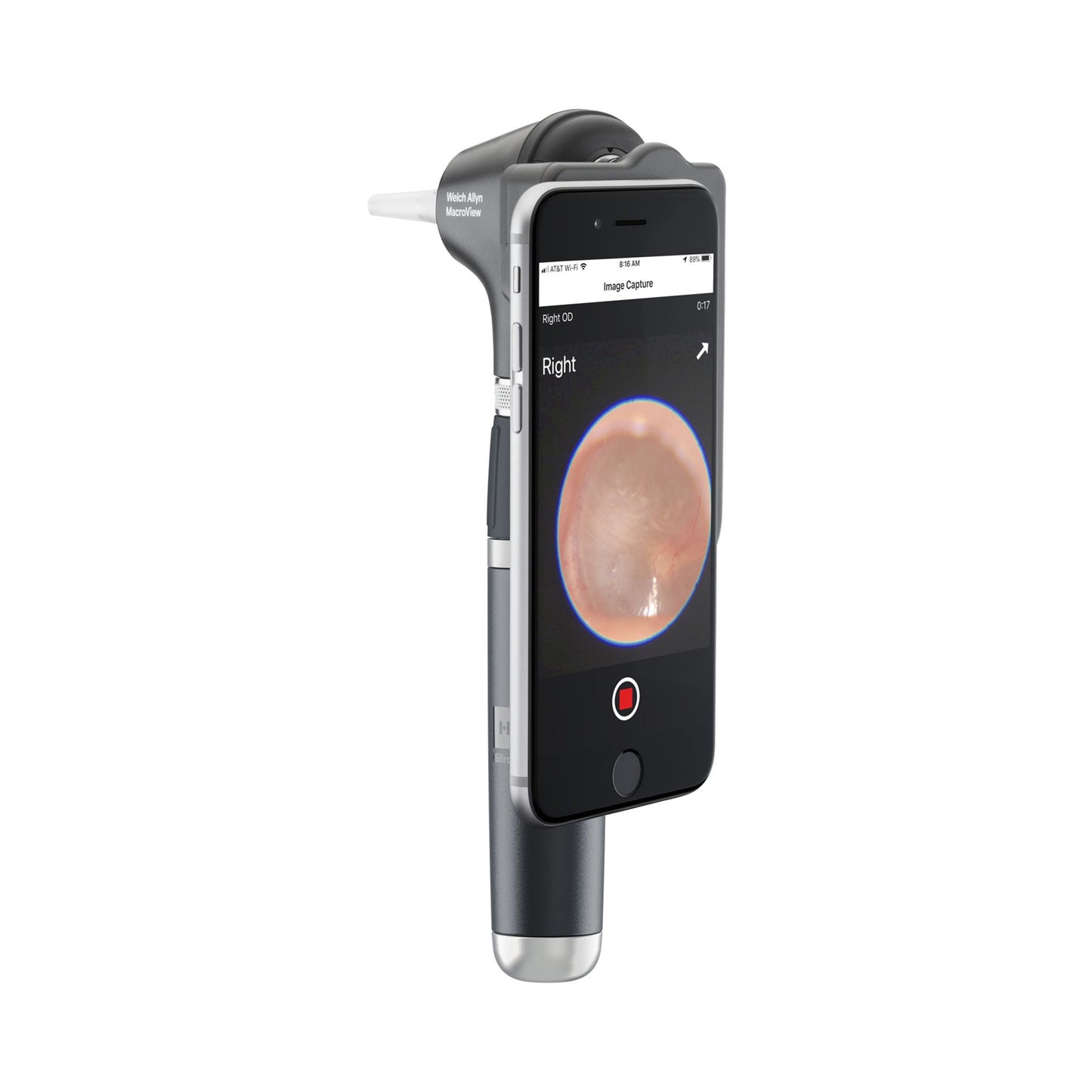 Welch Allyn MacroView Plus Otoscope Head for iExaminer